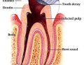 Endodontics Treatment Course in Mumbai – Your Gateway to Mastering Root Canal Excellence